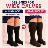 Ordinary compression socks versus Velora wide-fit — no digging, stays up